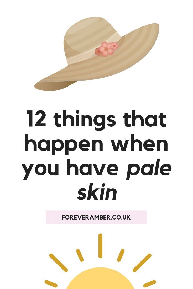 12 things that happen when you have pale skin