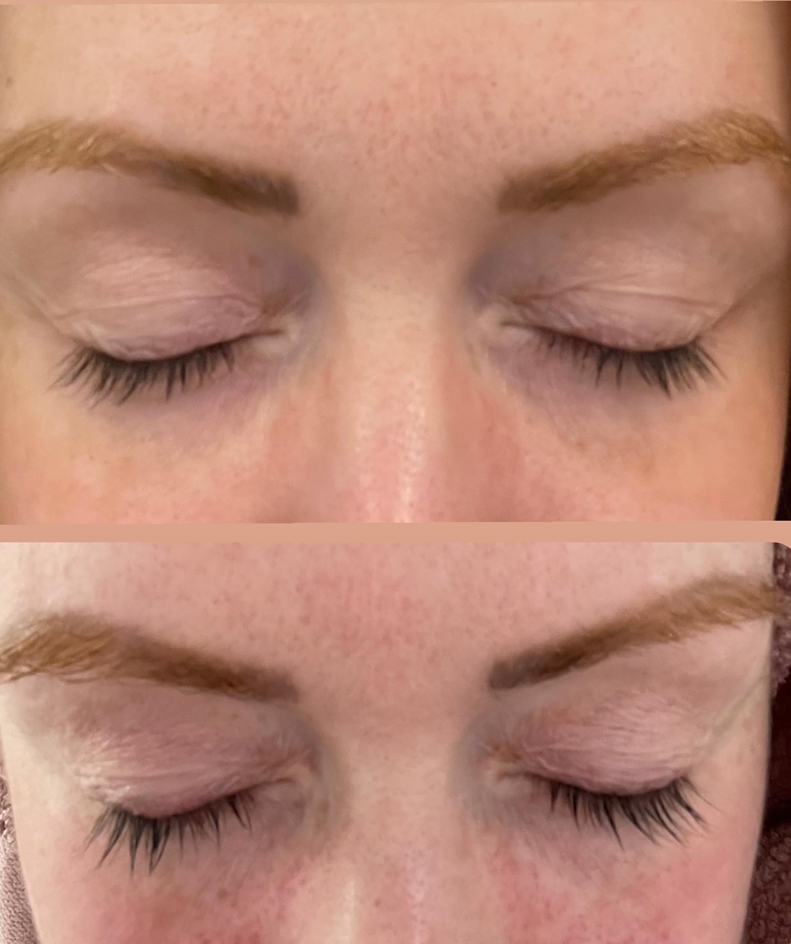 Rapidlash Eyelash Serum: before and after